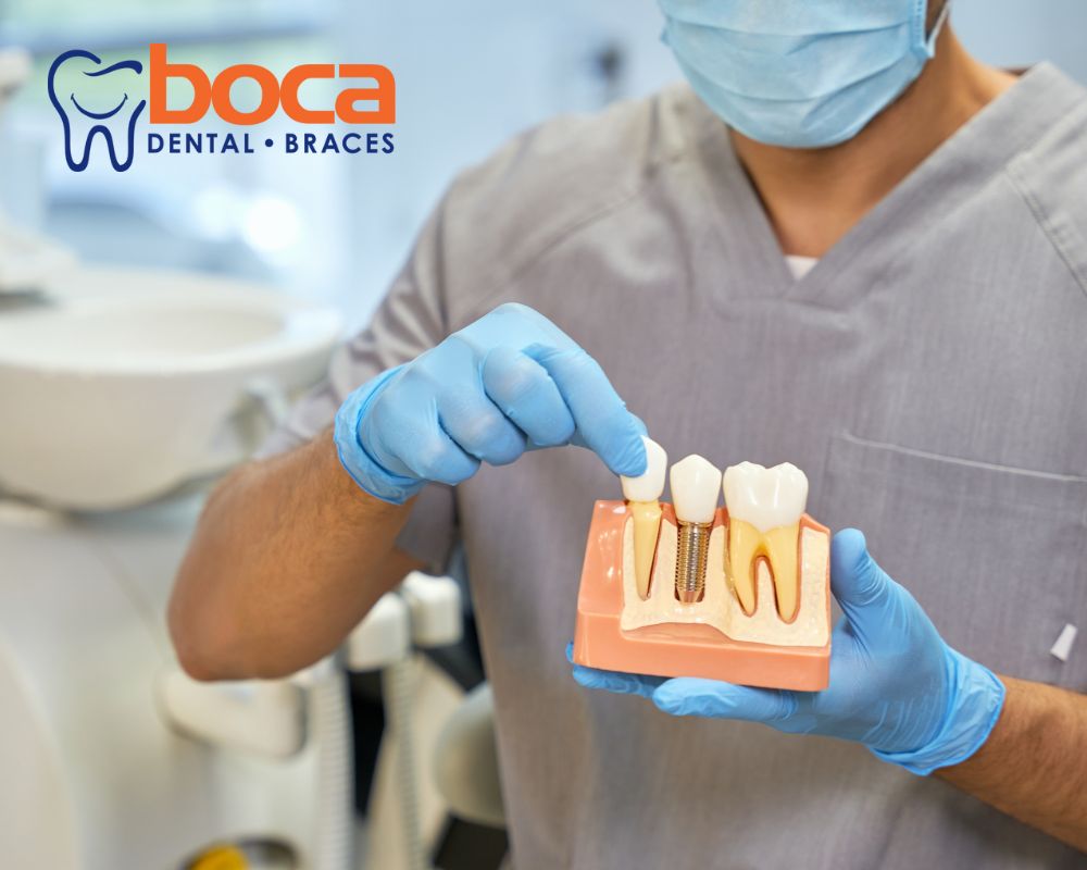Investing in Your Smile: The Lifelong Benefits of Dental Implants
